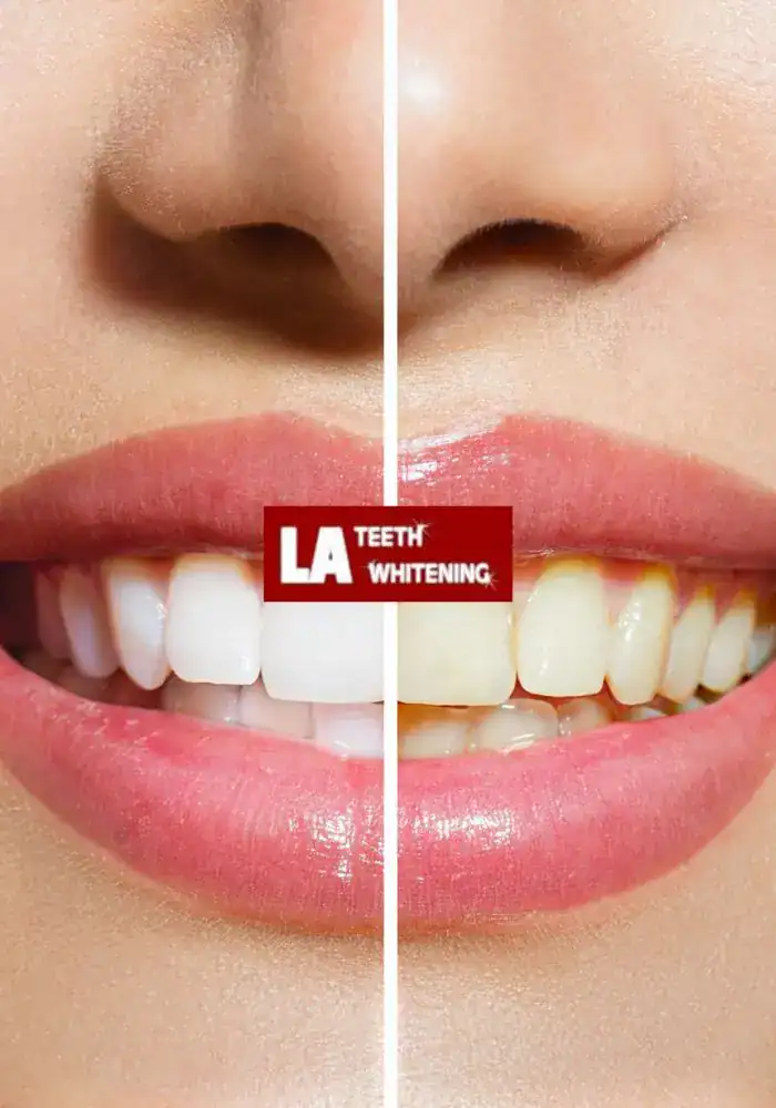 What Makes Professional Whitening Clinics Stand Out Southend on Sea
